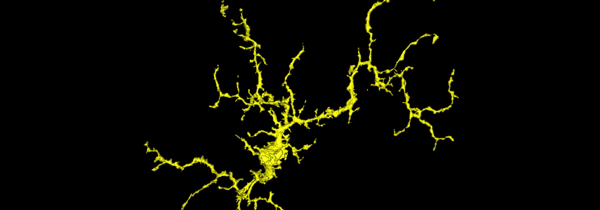 Microglial cell imaged by the Schallek lab